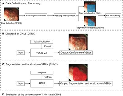 Diagnosis and segmentation effect of the ME-NBI-based deep learning model on gastric neoplasms in patients with suspected superficial lesions - a multicenter study